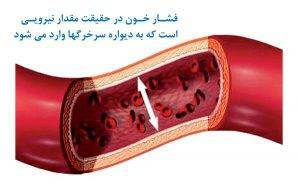 فشار خون بالا-دکتر حمیدرضا صنعتی بهترین متخصص و فوق تخصص قلب و عروق خوب در تهران